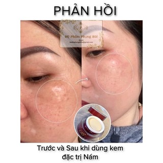 KEM NÁM PB [ Hàng chính hãng ]