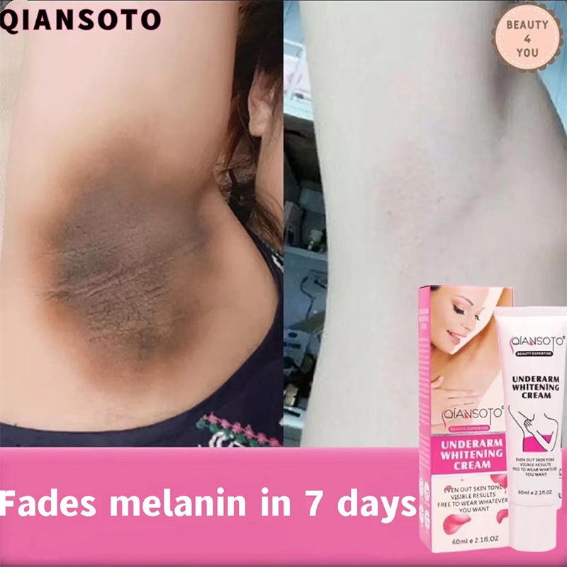Bảo mật thông tin giao hàng QIANSOTO Kem Làm Trắng Da Nách Giảm Thâm Đầu Gối Mông Bikini Khử Mùi Hôi Dưỡng Trắng Da 60g