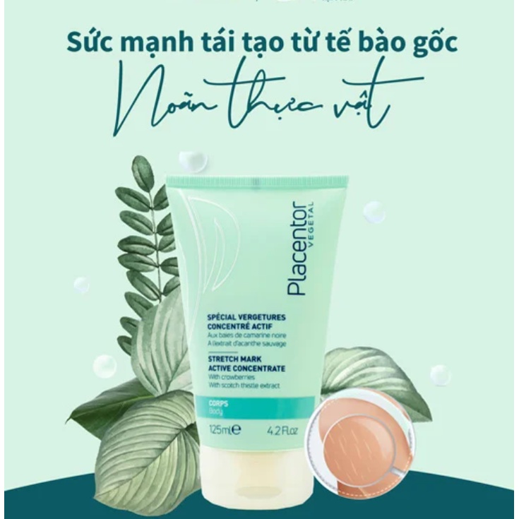 Kem dưỡng Placentor Stretch Marks cải thiện rạn da 125ML