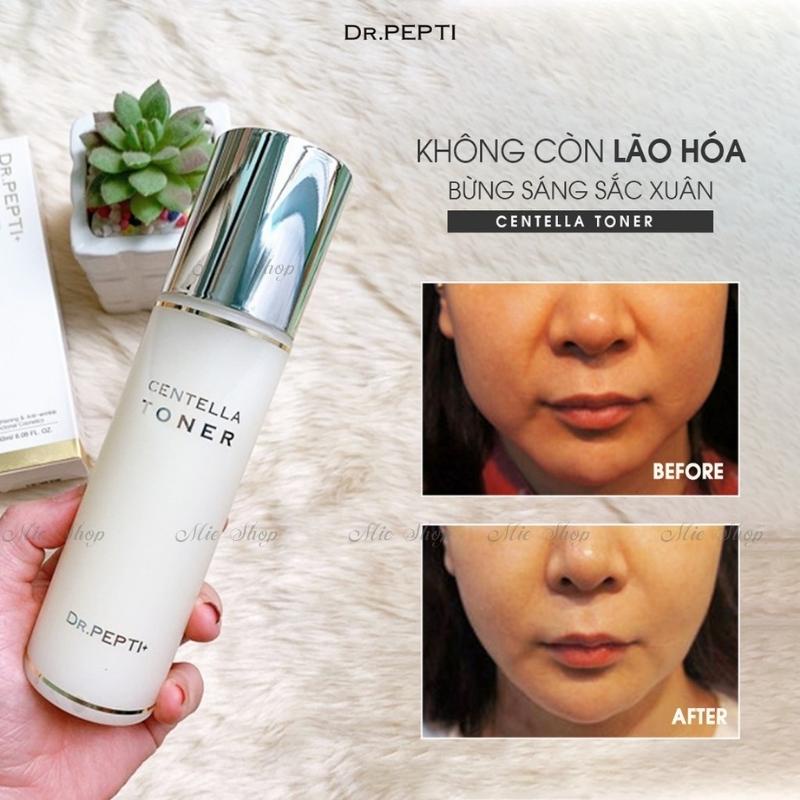 Toner Pepti ,Nước Hoa Hồng Dưỡng Da Căng Bóng Dr.Pepti Centella Toner 180ml ,cấp ẩm , căng bóng trẻ hóa da tức thì