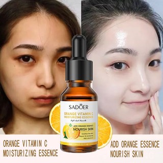 Serum vitamin c orange vitamin c moisturizing essence, serum sáng da, mờ thâm nám, dưỡng ẩm, ngăn ngừa mụn cải thiện làn