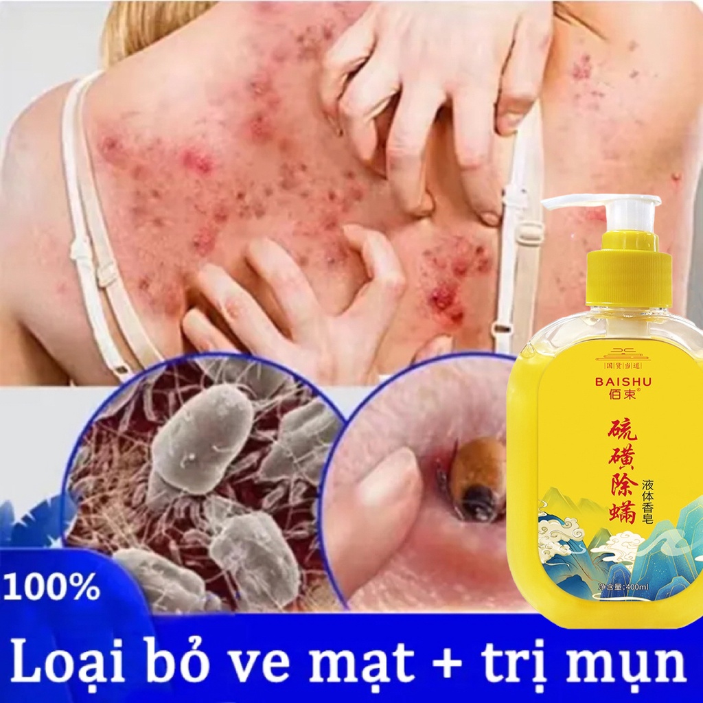 sữa tắm trắng da Sữa tắm chống ve sữa tắm 400ML Làm sạch sâu bụi bẩn dưới da Cải thiện mụn trứn