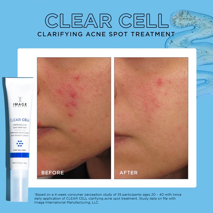 Gel chấm mụn và giảm viêm cấp tốc Image Clear Cell Clarifying Salicylic Belmeish 2% Salicylic Acid và Zinc PCA Gel 3g