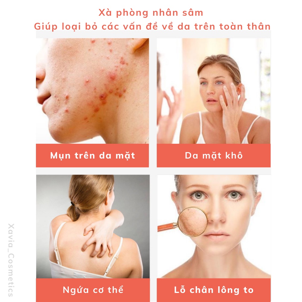 Xà phòng tắm nhân sâm cao cấp - Loại bỏ bã nhờn, kiểm soát mụn hiệu quả, làm sạch sâu, sáng da và mờ các vết thâm sạm