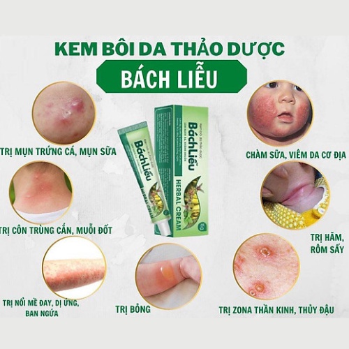 Kem Bôi Da Thảo Dược Bách Liễu - Dùng Cho Người Gặp Các Vấn Đề Da Liễu: Viêm, Nấm, Ngứa, Á S.ừng