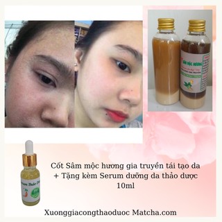 Cốt Sâm mộc hương gia truyền tái tạo da + Tặng kèm Serum dưỡng da thảo dược 10ml