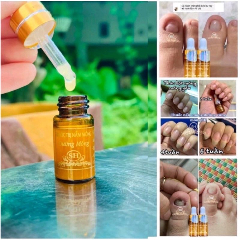 Serum Nấm Móng Tay Chân Khử Nấm Móng Hư Khóe Bọng Móng Nặng Nước Ăn Tay Chân gia Truyền