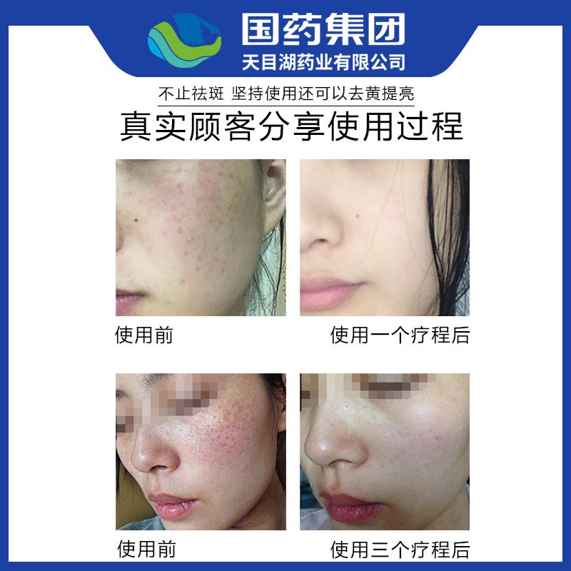 Serum tế bào gốc tái tạo da FOEO, tinh chất dưỡng da FOEO dưỡng trắng sáng, loại bỏ nám, mụn, tàn nhang, không đều màu