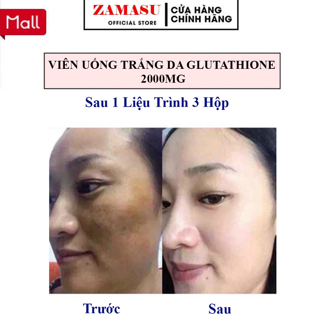 Viên Uống Trắng Da Mờ Nám Giảm Nếp Nhăn Glutathione Collagen 2000mg Hàng Chính Hãng Hộp 30 Viên | BigBuy360 - bigbuy360.vn