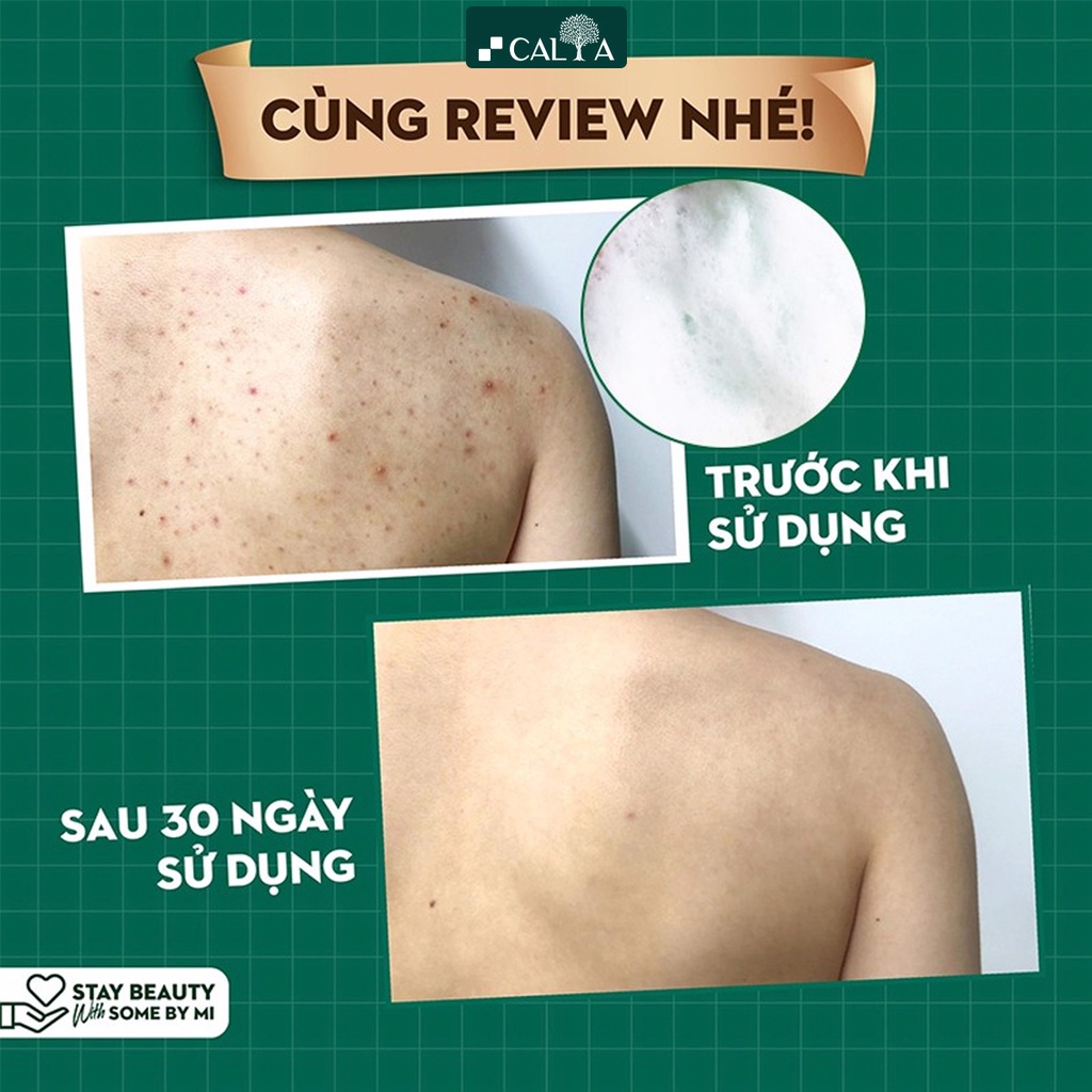 Sữa Tắm Some By Mi Giảm Mụn Cơ Thể, Làm Sạch Sâu - Some By Mi AHA BHA PHA 30 Days Miracle Acne Clear Body Cleanser 400g