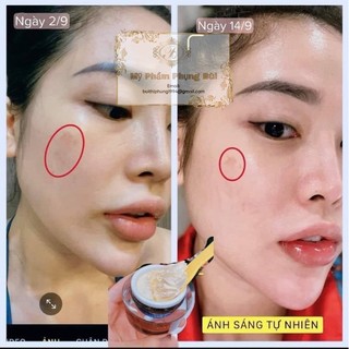 KEM NÁM PB [ Hàng chính hãng ]