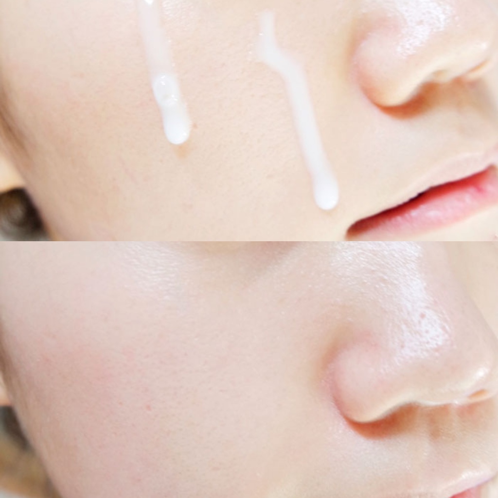Serum chống lão hóa Medi Peel Bortox 30ml - Dưỡng ẩm và làm trắng da