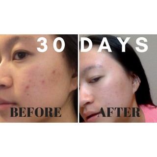Mặt nạ đất sét Aztec Secret Healing Clay