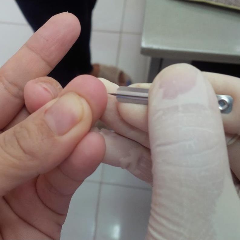 Kim lấy mụn - Kim chích máu Blood Lancet Hộp 200 cây