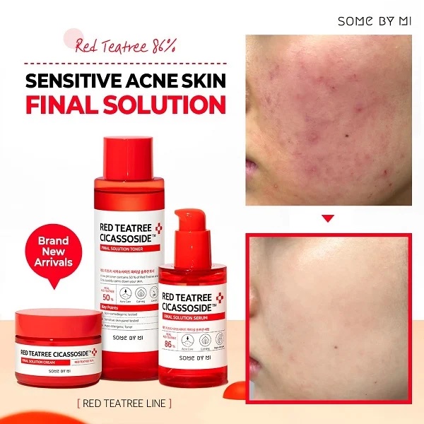 Some By Mi Red Teatree Cicassoside Toner - Serum - Kem dưỡng - Bebeau