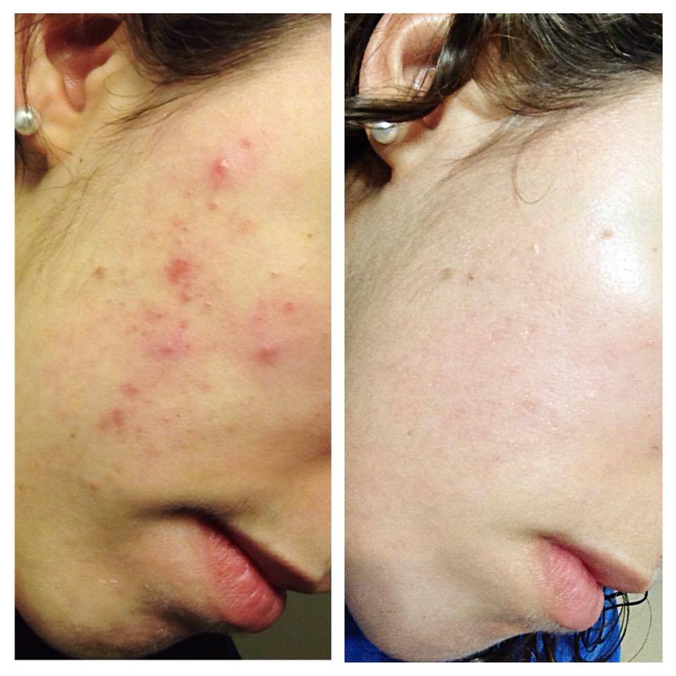 SERUM TÁI TẠO DA NHÂN SÂM Loại Mạnh Chính Hãng SẮC DƯỢC THIÊN 30ml - cải thiện nám tàn nhang xóa mụn tri kỷ da đẹp