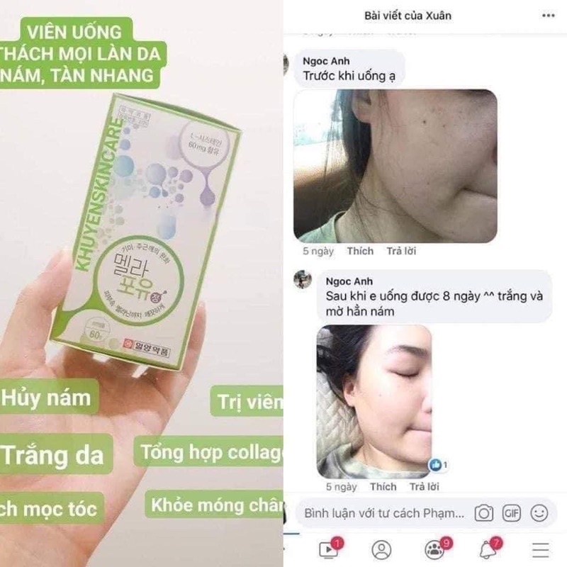 VIÊN UỐNG MỜ NÁM SÁNG DA MELA FOR YOU