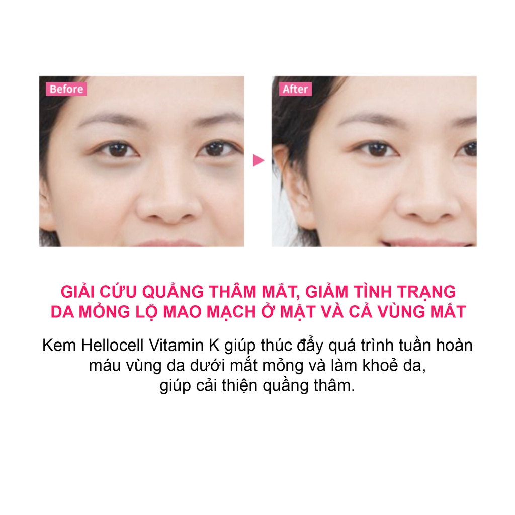 KEM VITAMIN K PHỤC HỒI SAU XÂM LẤN