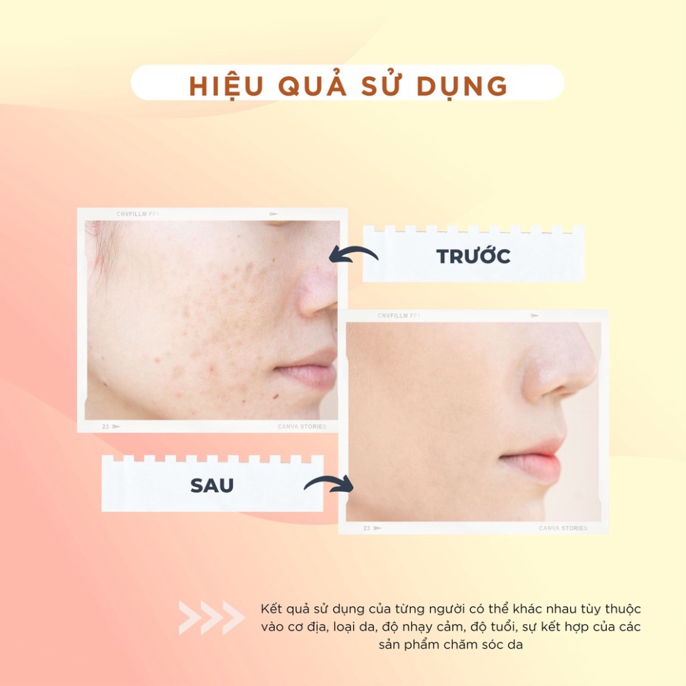 Kem dưỡng trắng da và Serum CHAMIS - Giúp se khít lỗ chân lông, giảm vết thâm, đều màu da