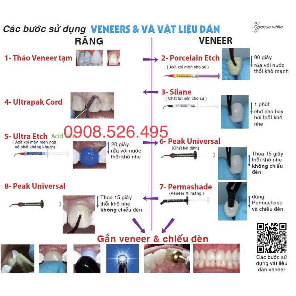 Bộ gắn sứ, sửa sứ, veneer Ultradent Mỹ
