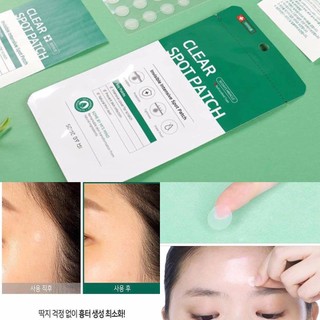 Miếng Dán Giảm Mụn Some By Mi Clear Spot Patch (Set 18 miếng)