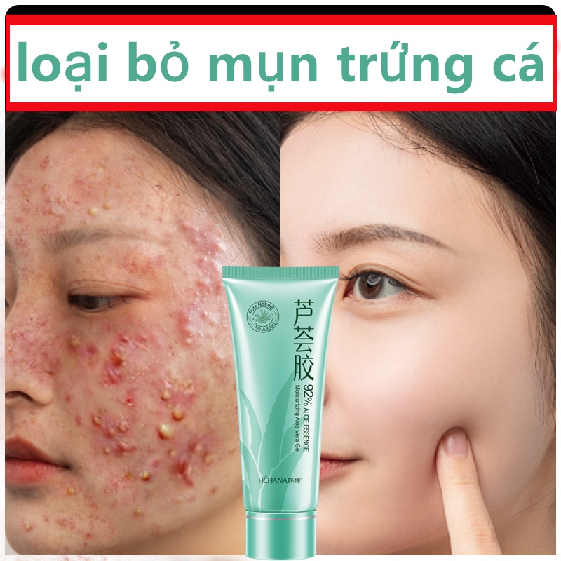 kem dưỡng ẩm trắng da mặt Gel lô hội nhập khẩu Hydrat hóa da Sửa chữa mặt trời Da khô Ban đêm Ban ngày Nữ Cho nam