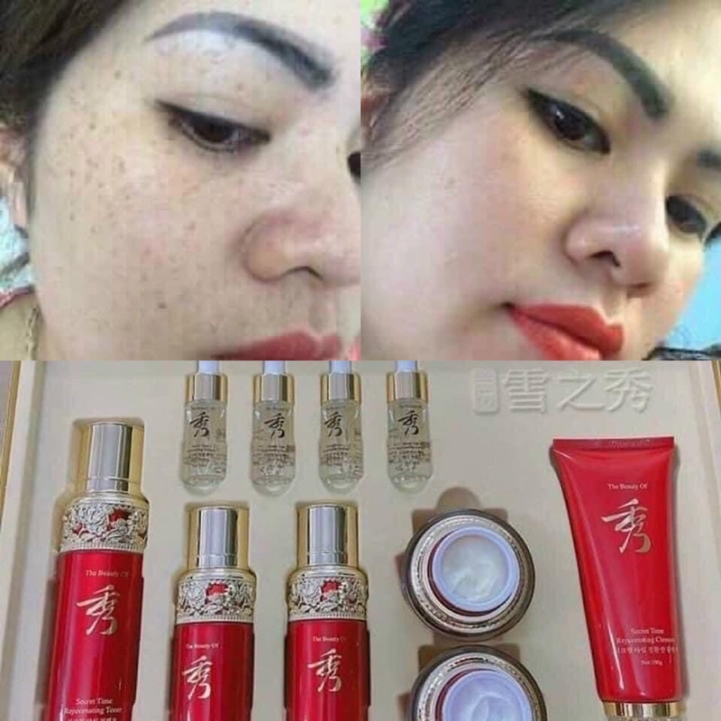 Bộ Mỹ Phẩm Lanhua Hàn Quốc Cao Cấp 7in1 Dưỡng Trắng Da Mờ Nám Tàn Nhan