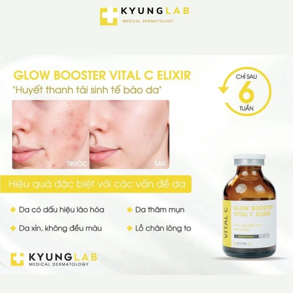 Vitamin c Kyunglab, serum trắng da vital c Kyung Lab 30ml, huyết thanh tái sinh tế bào da, xóa mụn nám, lão hóa | BigBuy360 - bigbuy360.vn