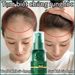 「🎀 TikTok Được giới thiệu bởi」 Tinh chất mọc tóc tinh chất chống rụng tóc 30ml cải thiện xơ rối rụng chắc khỏe chân tóc