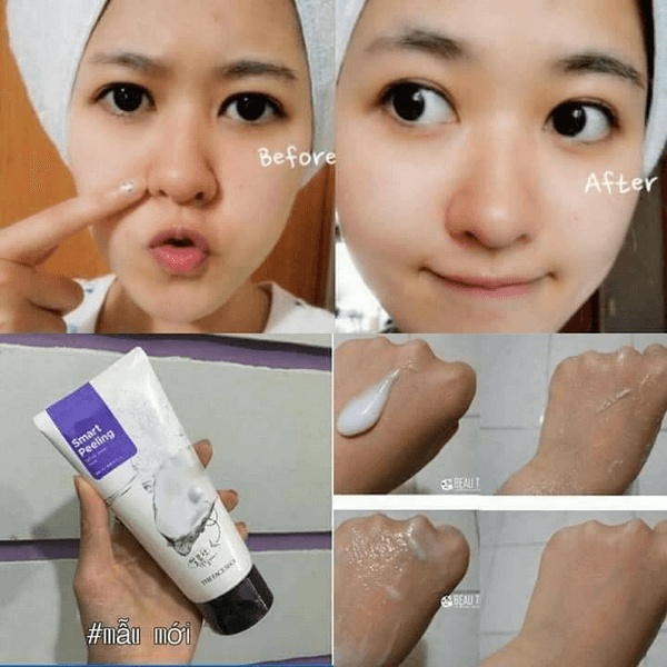 TẨY DA CHẾT / THE FACE SHOP /Tẩy Da Chết Ngọc Trai - White Jewel PeelingThe Face Shop Smart Peeling 120ml ư