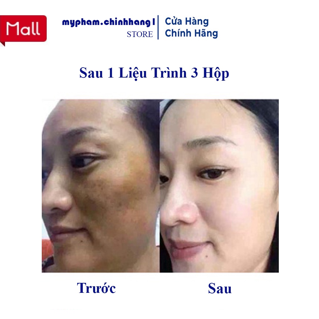 Viên Uống Trắng da COLLAGEN - GLUTATHIONE 2000 - Trắng Da,Mờ Nám,Giảm Nhăn. | BigBuy360 - bigbuy360.vn