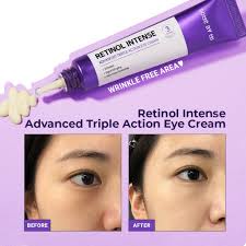 Kem Mắt Some By Mi Retinol Intense Advanced Triple Action Eye Cream 30ml
