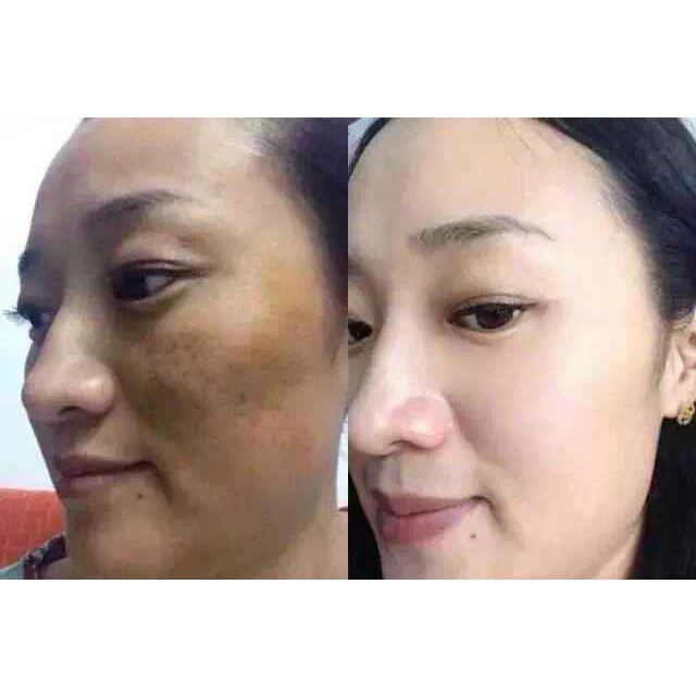 SERUM TÁI TẠO DA NHÂN SÂM Loại Mạnh Chính Hãng SẮC DƯỢC THIÊN 30ml - cải thiện nám tàn nhang xóa mụn tri kỷ da đẹp