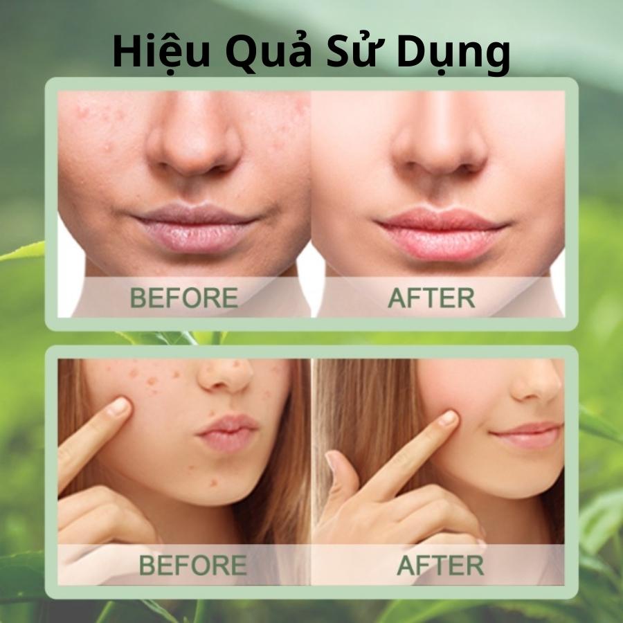 Mặt Nạ Đất Sét Trắng Da Green Tea Mask Stick Mặt Nạ Trà Xanh Giảm Mụn Đầu Đen Hiệu Quả Rửa Sạch Sâu Lỗ Chân Lông