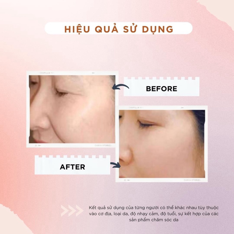 Kem dưỡng trắng mờ thâm nám TOPCHARM - giúp căng bóng trẻ hóa làn da 30g