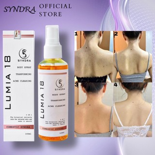 Xịt mụn lưng ngực Syndra giảm mụn, mờ thâm, sáng da hiệu quả