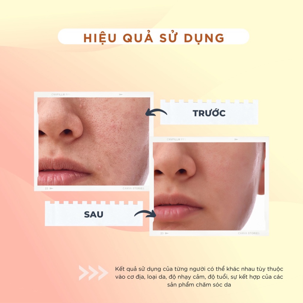Kem dưỡng Trắng Da COLLAGEN - Ngừa lão hóa, tàn nhang - Giúp Phục Hồi, Ngừa Thâm Nám - CHAMIS 15g