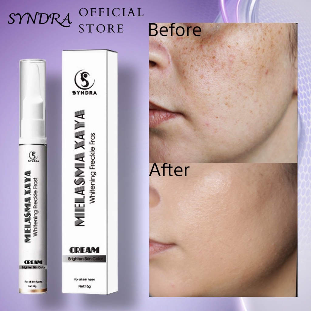 Kem nám tàn nhang Melasma Xayya 15ml giảm đốm nâu, làm đều màu da