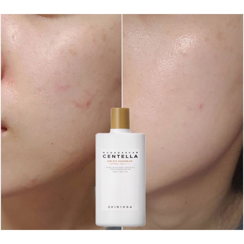 ☀️ Kem Chống Nắng Skin1004 Cho Da Nhạy Cảm SPF 50+ PA++++ 50ml ☀️