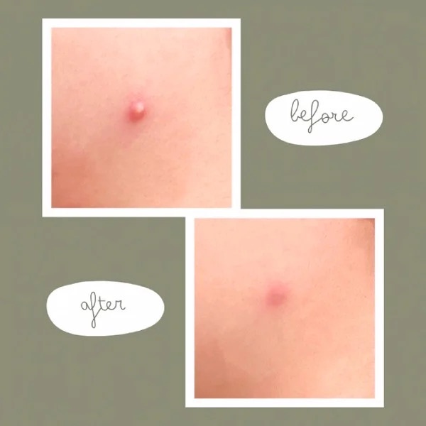 Tinh chất rau má làm dịu phục hồi da Mary & May Centella Asiatica Serum 30ml