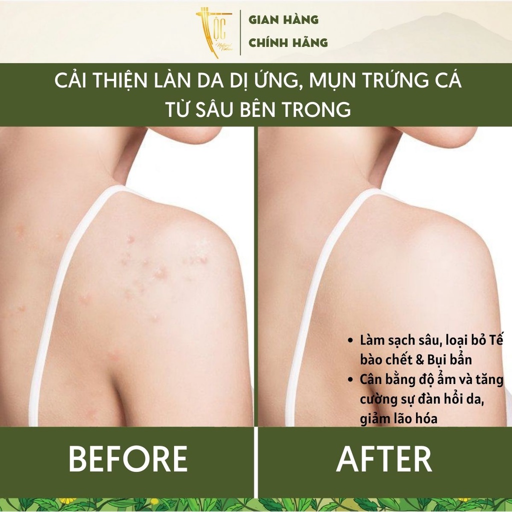 Combo 2 Sữa tắm Mướp đắng rừng & Tràm trà Cao Bằng TỘC Natural sạch khuẩn, giảm mụn và viêm nang lông 300ml