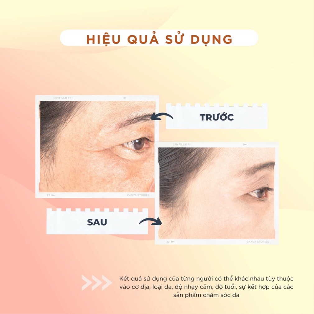KEM DƯỠNG DA CHAMIS -  TRẺ HÓA CHUYÊN SÂU, CẤP ẨM GIÚP TÁI TẠO DA