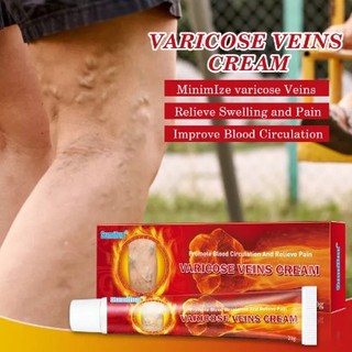 Kem Bôi Suy Giãn Tĩnh Mạch Varicose Veins Cream Cực Hiệu Quả