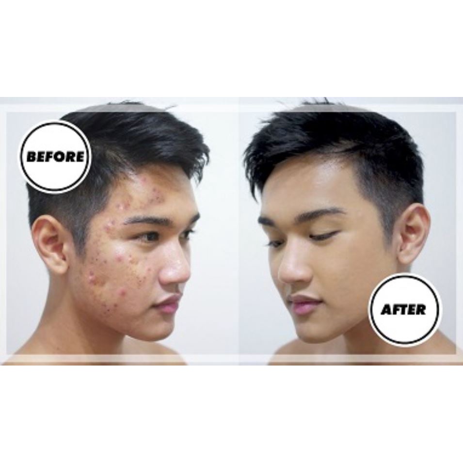 SERUM TÁI TẠO DA NHÂN SÂM Loại Mạnh Chính Hãng SẮC DƯỢC THIÊN 30ml - cải thiện nám tàn nhang xóa mụn tri kỷ da đẹp