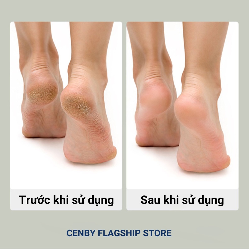Máy chà gót chân CENBY C500 tẩy tế bào chết cho tiệm nail, cá nhân tại nhà giúp làm mềm sáng gót chân