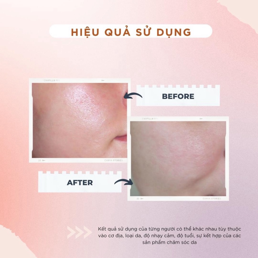 Kem dưỡng trắng sáng da TOPCHARM - giúp da trắng hồng, mịn màng, loại bỏ thâm nám tàn nhang