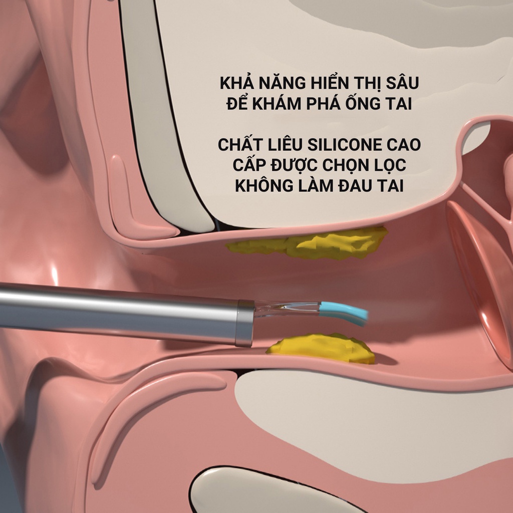 Máy lấy ráy tai XLIFE theo dõi qua ứng dụng trên điện thoại độ phân giải chất lượng cao 500W