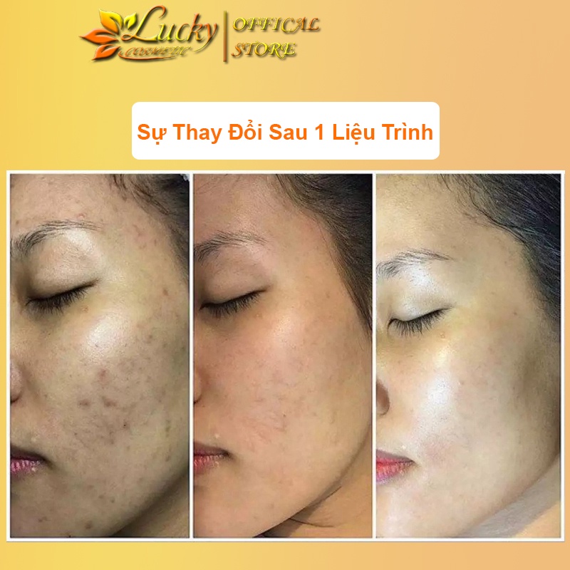 COLAGEN RETINOL Viên Uống Giúp Da Căng Bóng Sáng Không Nếp Nhăn Hộp 30 Viên
