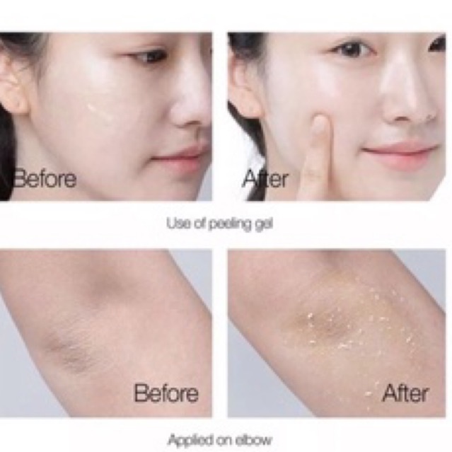 Tẩy tế bào chết Prettyskin 150ml