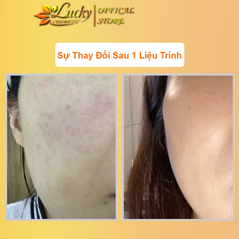 GLUTATHIONE 16000mg Viên Uống Trắng Da Mờ Nám Làm Chậm QUá Trình Lão Hóa Da Chính Hãng Hộp 2 Lọ 30 Viên